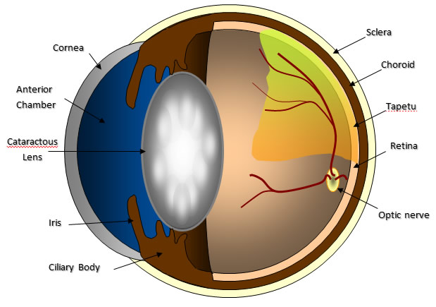 Does Medicare Cover Cataract Surgery?