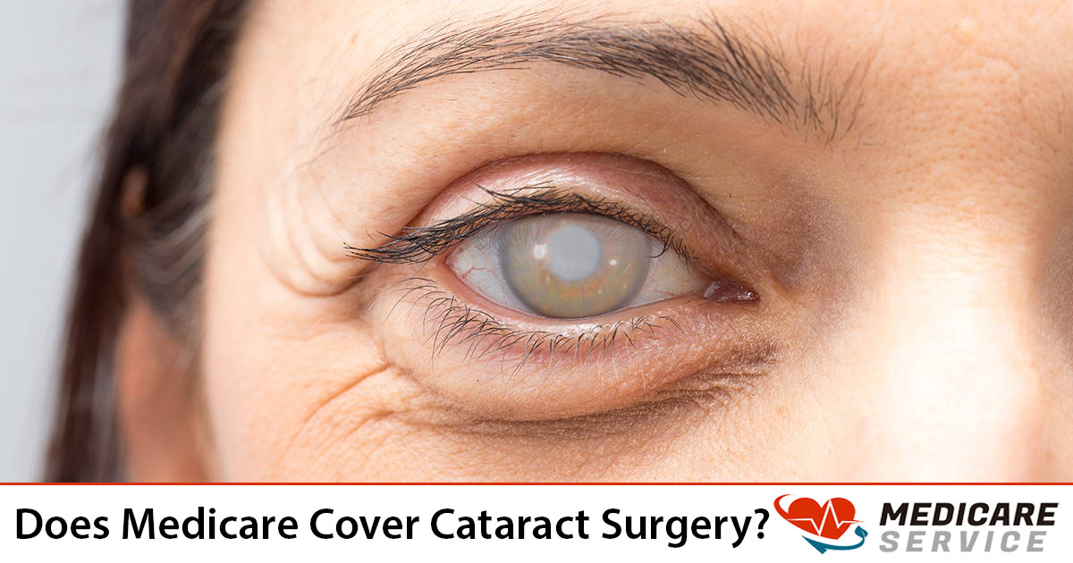 Does Medicare Cover Cataract Surgery?