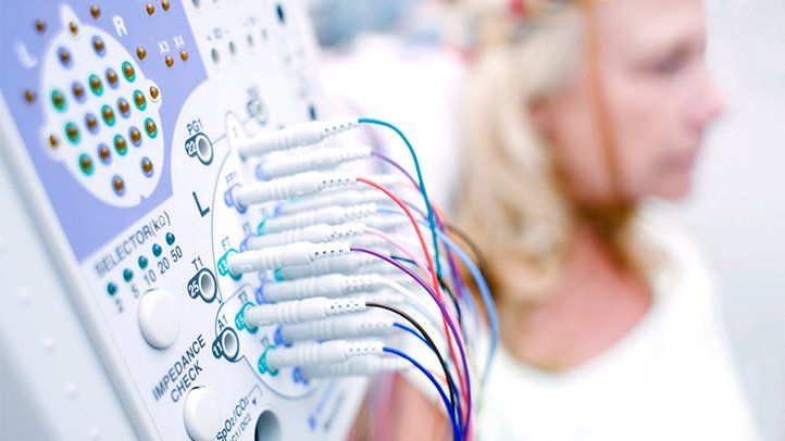 Things you Need to Know About Medicare Coverage for Epilepsy