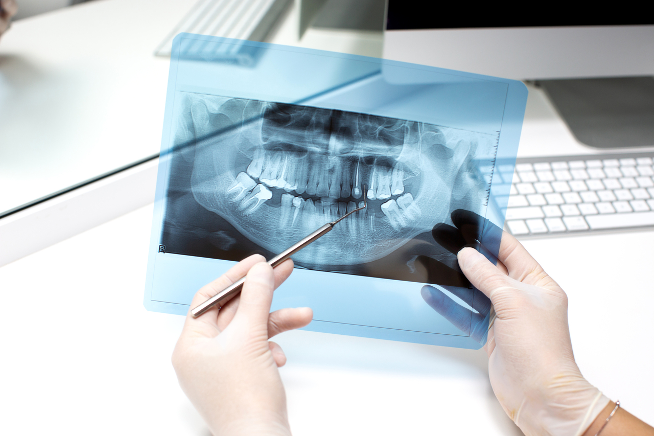 Picture-Perfect Smiles: Understanding Dental X-rays and Medicare Benefits